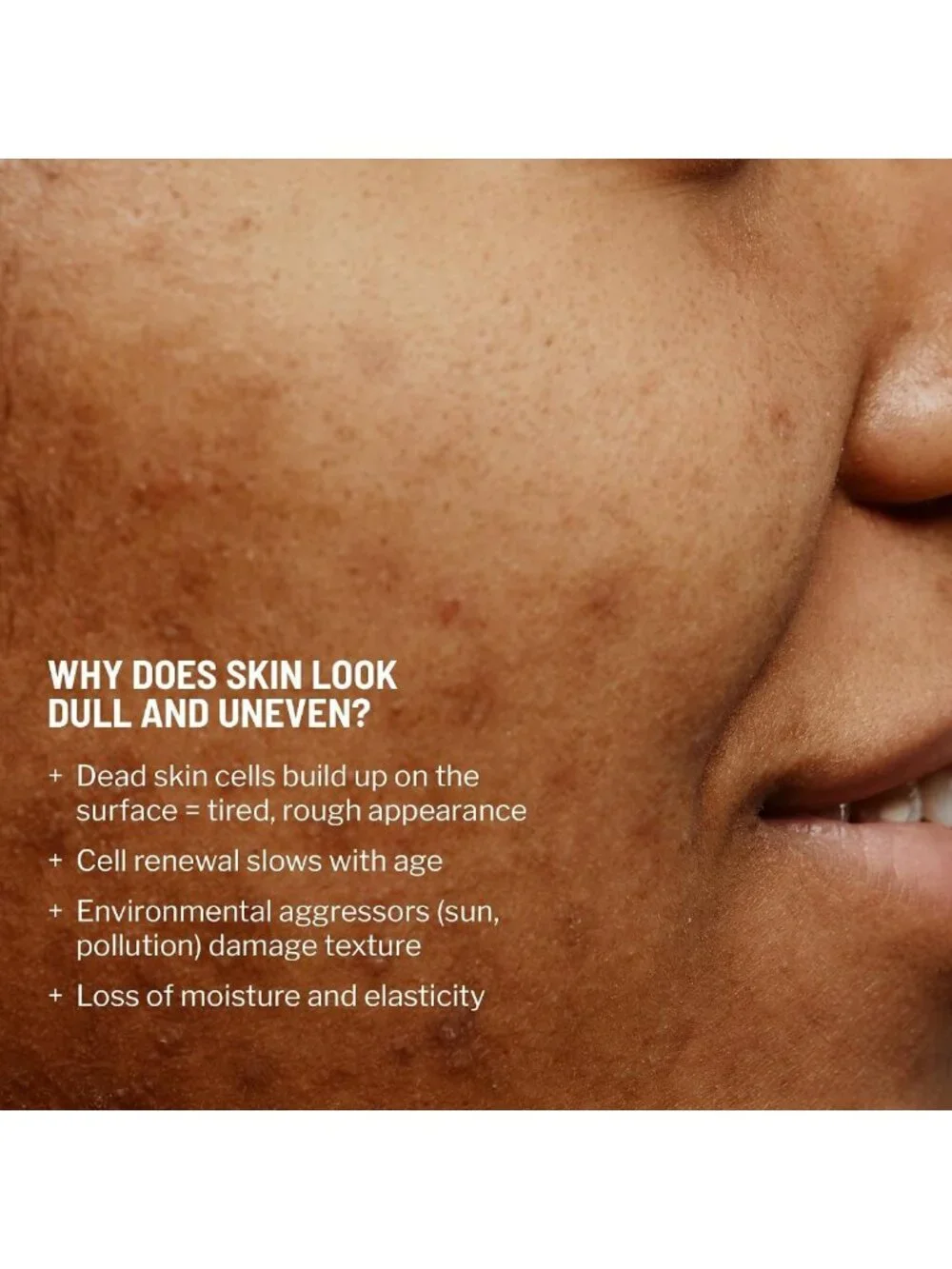 Travel Size Microdermabrasion Exfoliator - Refines Texture, Reduces Fine Lines